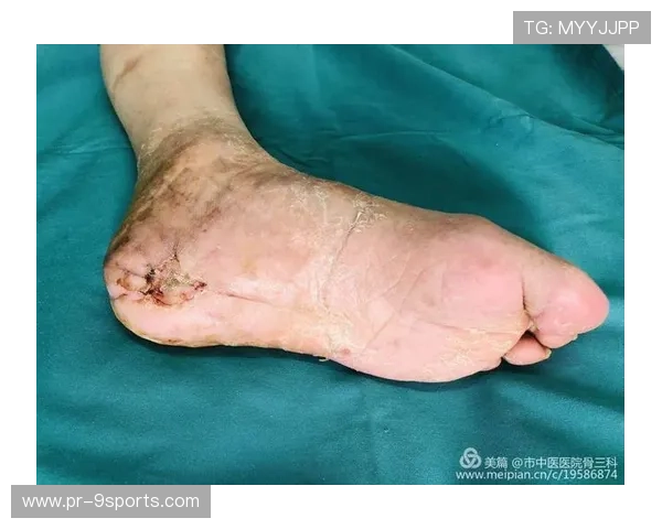 法兰克福引领未来健康新航向：全新康复与营养系统革新亮相